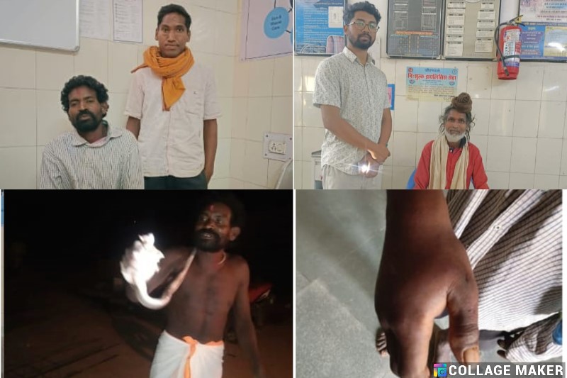 जशपुर : झाड़ फूंक करने वाला बाबा सांप काटने पर डाक्टरों की शरण में आकर बचाई अपनी जान