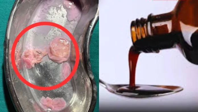 बोतल के अंदर ‘मांस जैसी वस्तु’! छत्तीसगढ़ F&D विभाग अलर्ट, नमूना लैब भेजा—रिपोर्ट के बाद होगी FIR या प्रतिबंध की कार्रवाई