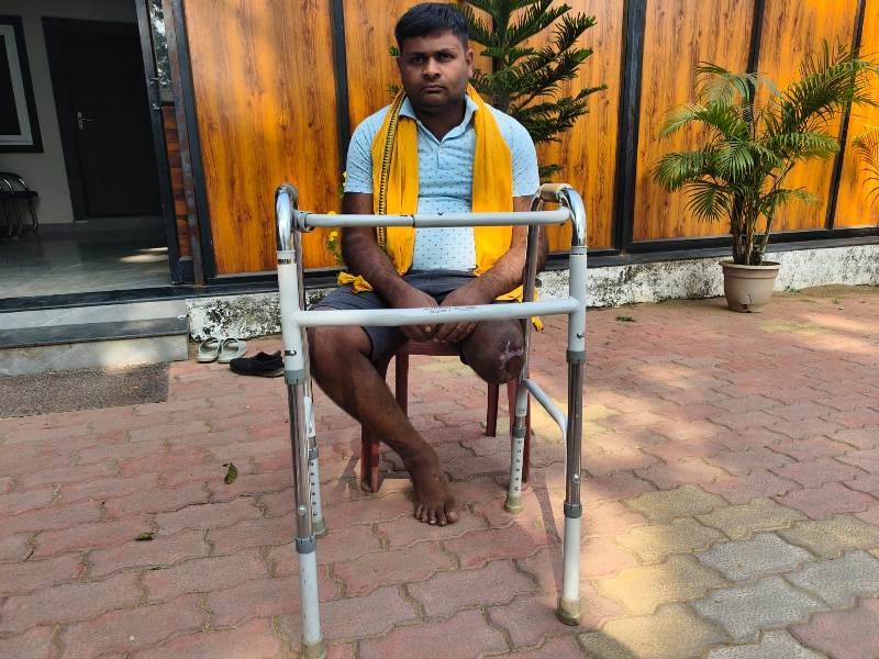 मानवता की मिसाल: दुर्घटना में पैर खोने वाले पुरेन्द्र के इलाज का जिम्मा सरकार ने लिया, कृत्रिम पैर लगाने की प्रक्रिया शुरू