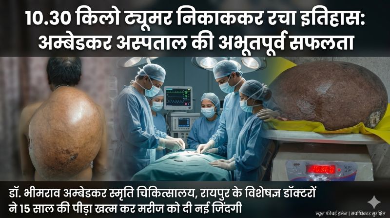छत्तीसगढ़ में चिकित्सा क्षेत्र की बड़ी उपलब्धि: 10.30 किलोग्राम वजनी जटिल ट्यूमर को हटाकर विशेषज्ञ डॉक्टरों ने असंभव को किया संभव, मरीज के जीवन में लौटी उम्मीद और आत्मविश्वास