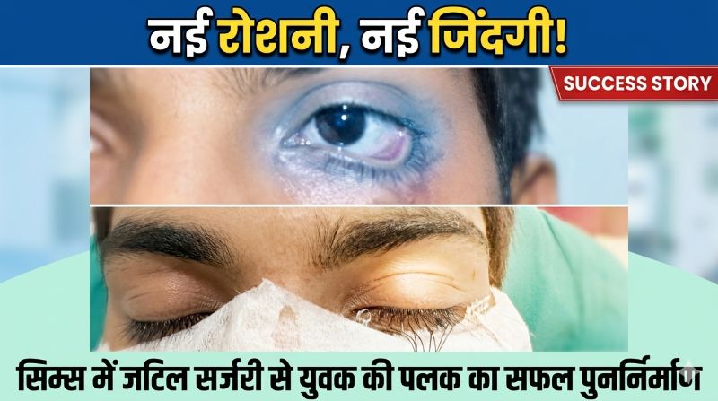 सरकारी अस्पताल में विश्वस्तरीय इलाज का उदाहरण—सड़क हादसे में घायल युवक को सिम्स के डॉक्टरों ने दी नई रोशनी, जटिल ऑपरेशन से पलक पुनर्निर्माण कर बदली जिंदगी
