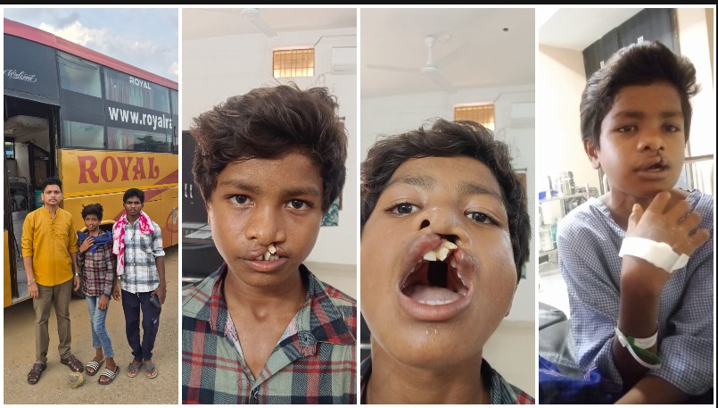 ‘चिरायु’ दल ने बदल दी मासूम की जिंदगी! जन्मजात कटे होंठ-तालु से मिली मुक्ति, चेहरे पर लौटी मुस्कान