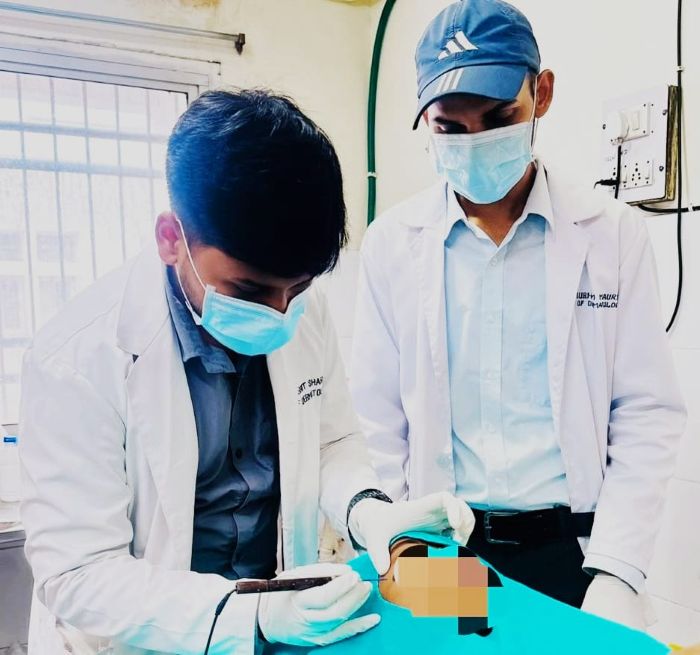 मुंहासे, पिगमेंटेशन से लेकर विटिलिगो और स्कार तक—अम्बेडकर अस्पताल में अत्याधुनिक डर्मेटोलॉजी उपचार, एक ही जगह मिल रही कई सुविधाएं