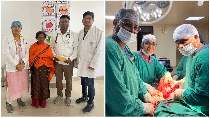 पेट में फुटबॉल जितना 8 किलो का ट्यूमर, जान बचाने डॉक्टरों ने किया जटिल ऑपरेशन; तीन विभागों की संयुक्त टीम ने सफलतापूर्वक निकाली विशाल गांठ