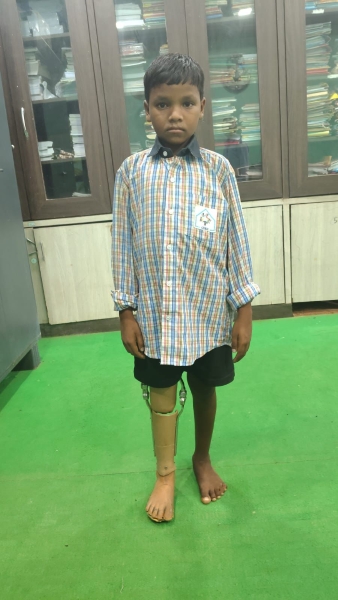 जिस कदम को सहारे की जरूरत थी, अब वही बढ़ेगा सपनों की ओर! कमलेश को मिला कृत्रिम पैर, नई उम्मीद के साथ बदलेगी जिंदगी की राह