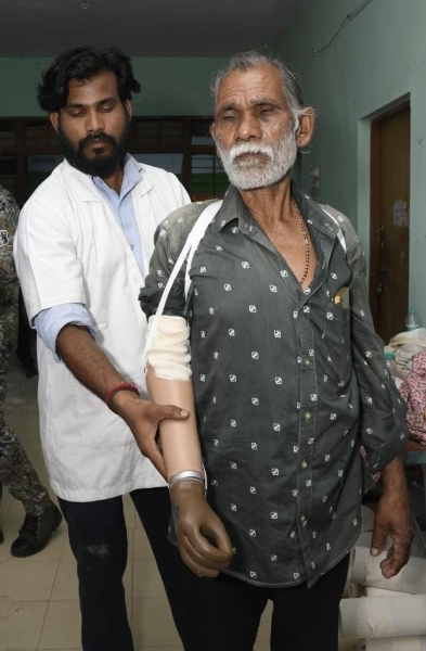 ट्रेन हादसे में हाथ गंवाया, लेकिन हौसला नहीं टूटा—‘निदान-03’ शिविर ने तेजराम के जीवन में फिर भरे रंग! डेढ़ से दो घंटे में तैयार हुआ कृत्रिम हाथ, अब दूसरों पर निर्भरता घटने और आत्मनिर्भर बनने की जगी उम्मीद