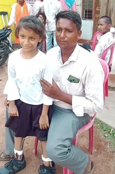 9 साल की लावण्या के लिए कभी सपना था अपने पैरों पर खड़ा होना, ‘निदान-03’ शिविर ने बदल दी जिंदगी! कैलिपर पहनते ही बढ़ाए नन्हे कदम तो खुशी से छलक उठीं माता-पिता की आंखें, सालों का संघर्ष उम्मीद में बदला; सेवा संकल्प अभियान की पहल ने मासूम को दी आत्मनिर्भरता की नई राह